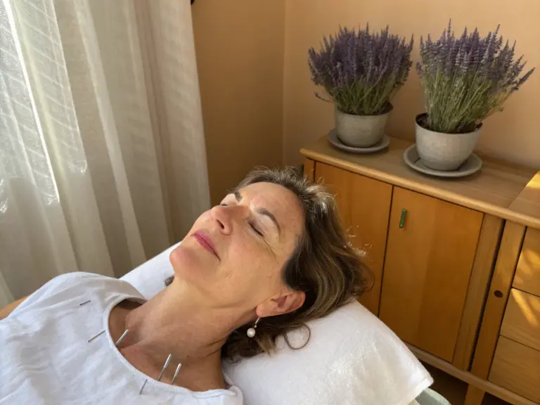 Acupuncture and dry needling at Bodywerks, Limassol